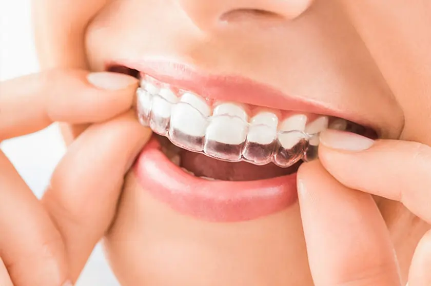 Dentist Rockhampton custom splint consultation