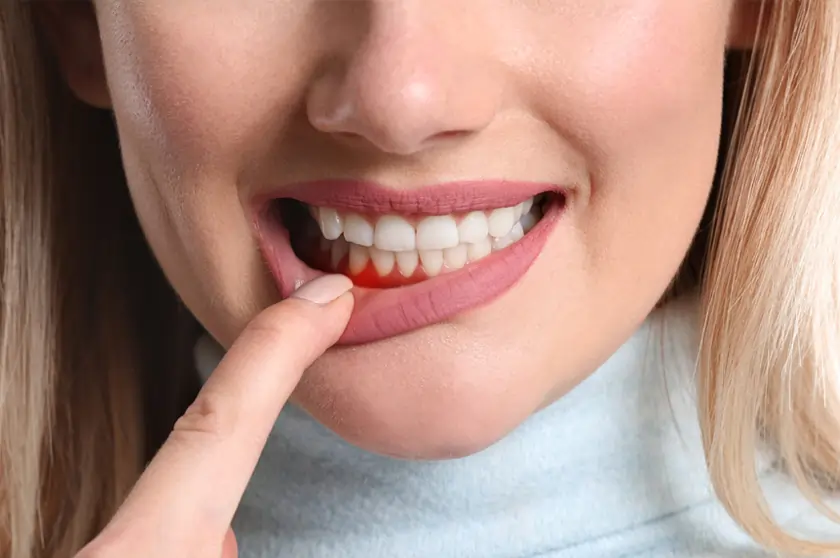 Dentists Rockhampton providing periodontal care