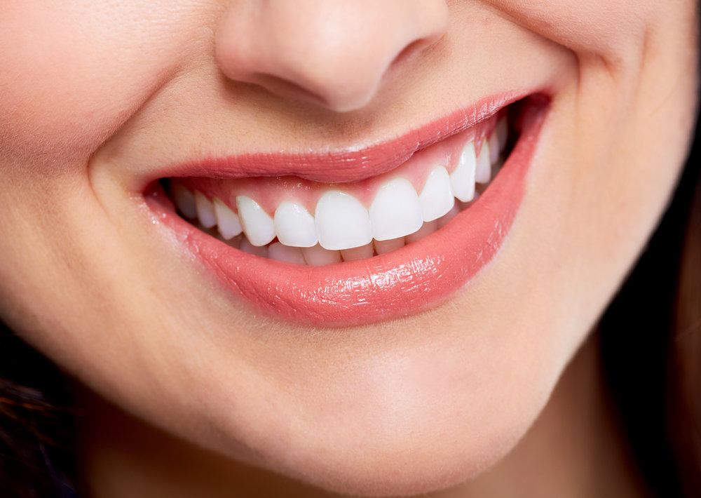 Smile makeover treatment at CQ Dental Studio Rockhampton